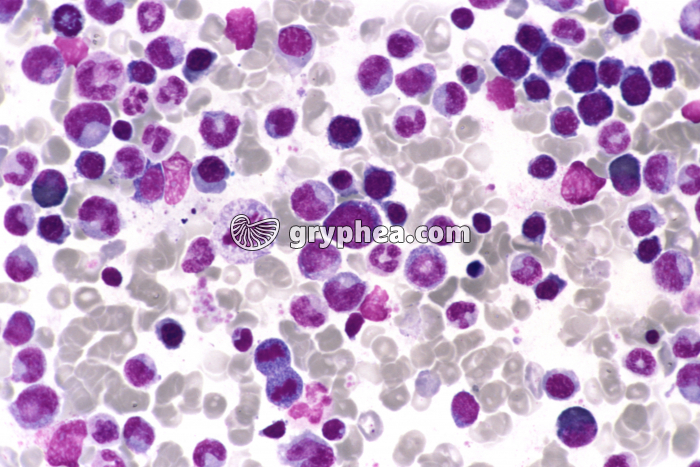 Moelle osseuse riche x200 - gryphea.com